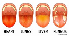Nhìn lưỡi đoán bệnh: 13 dấu hiệu không thể bỏ qua