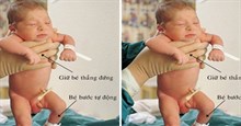 Lý giải hiện tượng kỳ lạ em bé vừa sinh ra đã bước đi như có phép màu