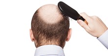 Thủ phạm gây ra chứng rụng tóc khi chúng ta già đi