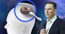 Chơi game bắn súng bằng ý nghĩ sau khi cấy chip não của Elon Musk