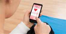 Cách đo nhịp tim trên Xiaomi