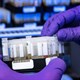 Thay đổi các chi tiết của bộ công cụ test